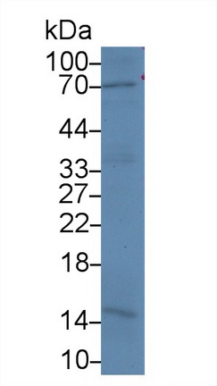 Monoclonal Antibody to Procollagen III N-Terminal Propeptide (PIIINP)