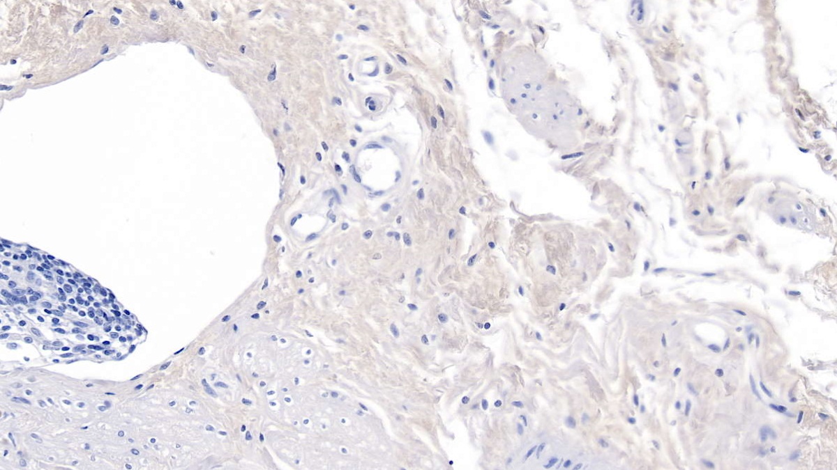 Monoclonal Antibody to Procollagen III N-Terminal Propeptide (PIIINP)