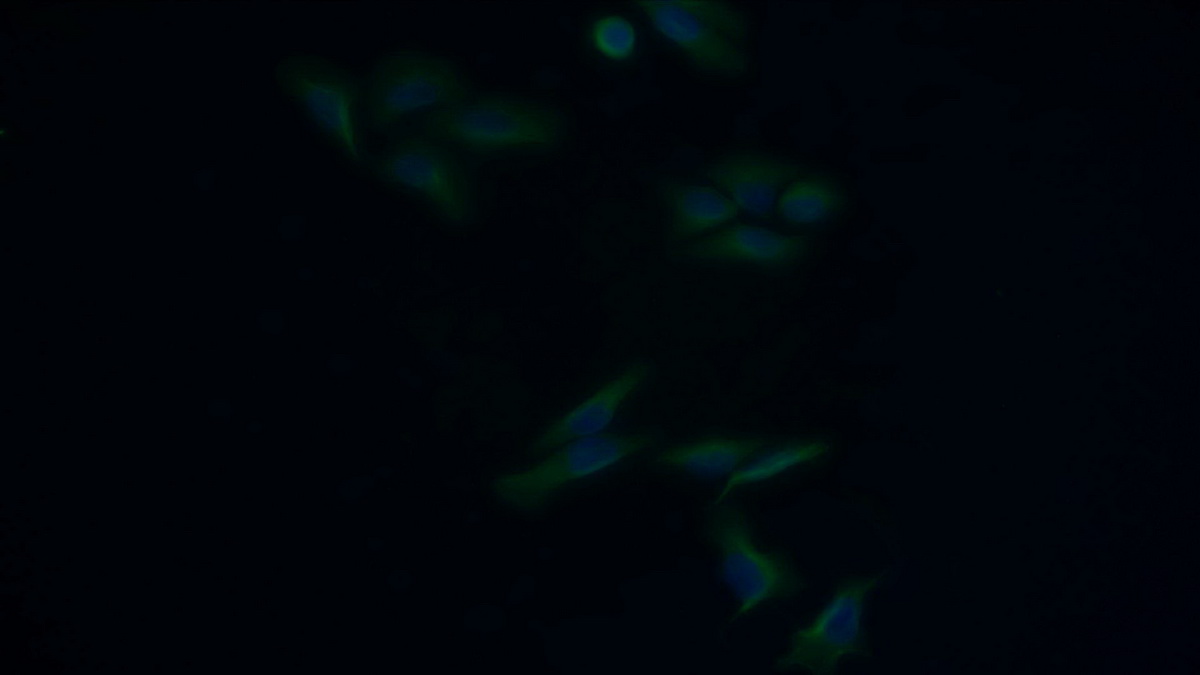 Monoclonal Antibody to Procollagen III N-Terminal Propeptide (PIIINP)