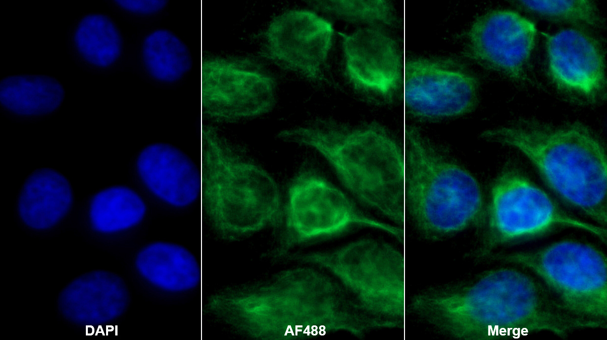 Monoclonal Antibody to Procollagen III N-Terminal Propeptide (PIIINP)