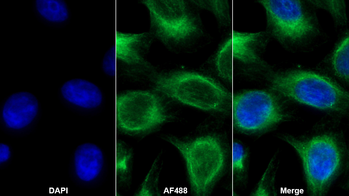 Monoclonal Antibody to Procollagen III N-Terminal Propeptide (PIIINP)