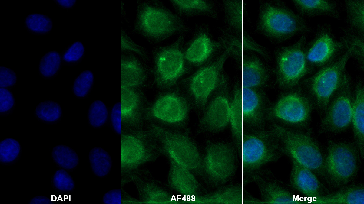 Monoclonal Antibody to Procollagen III N-Terminal Propeptide (PIIINP)