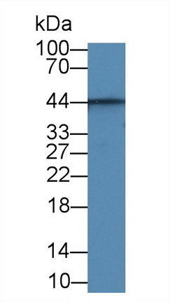 Monoclonal Antibody to Aquaporin 4 (AQP4)