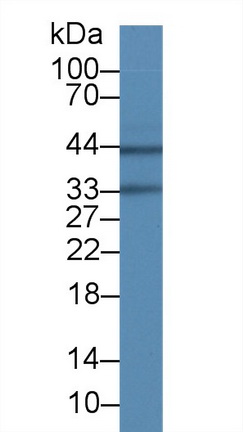 Monoclonal Antibody to Aquaporin 4 (AQP4)