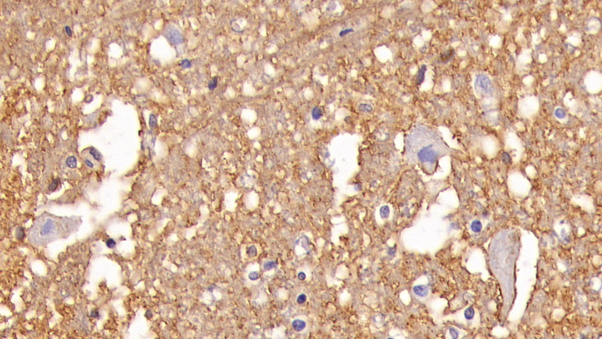 Monoclonal Antibody to Aquaporin 4 (AQP4)