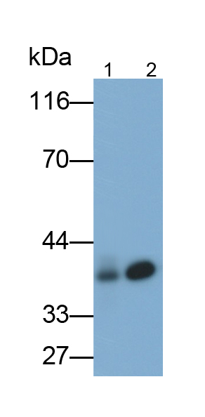 Monoclonal Antibody to Aquaporin 4 (AQP4)