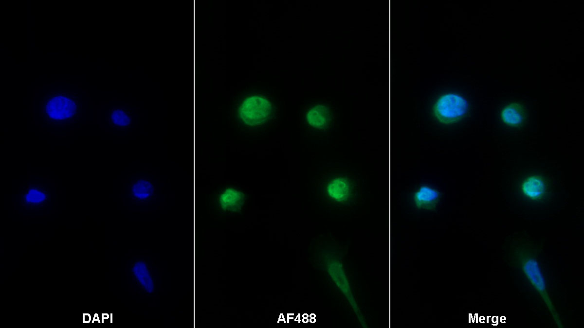 Monoclonal Antibody to Aquaporin 4 (AQP4)