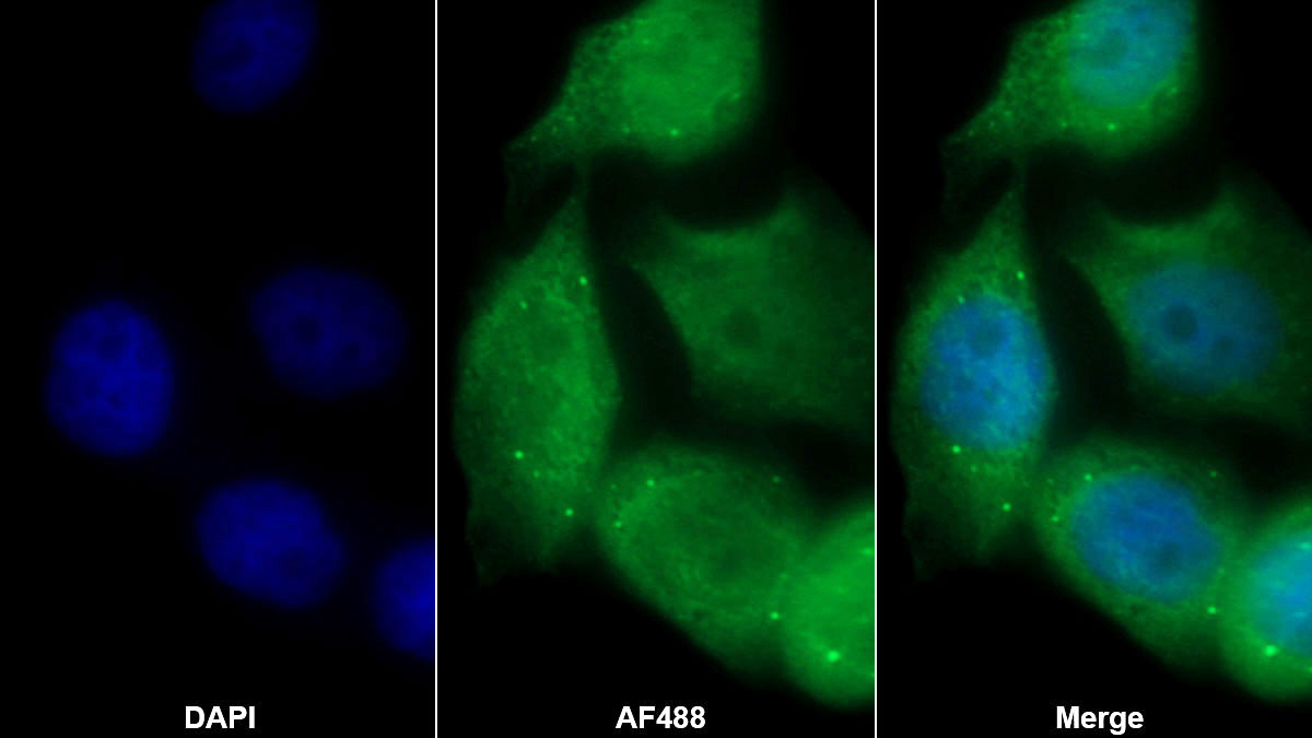 Monoclonal Antibody to Cyclin D1 (CCND1)