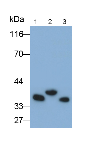 Monoclonal Antibody to Cyclin D1 (CCND1)