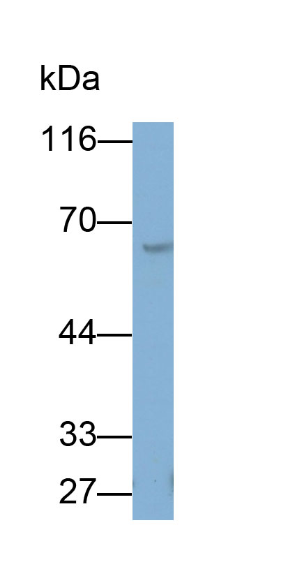 Monoclonal Antibody to Pyruvate kinase isozymes M2 (PKM2)