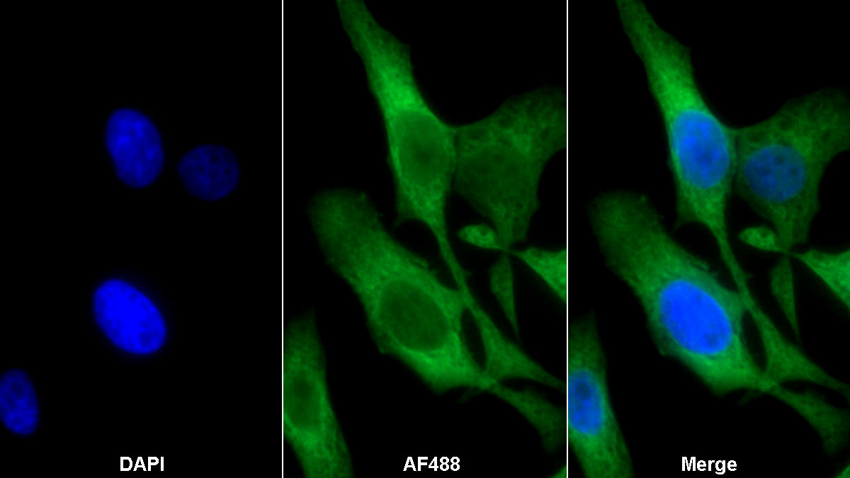 Monoclonal Antibody to Pyruvate kinase isozymes M2 (PKM2)