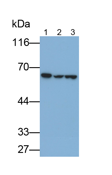 Monoclonal Antibody to Pyruvate kinase isozymes M2 (PKM2)