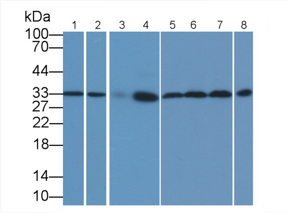 Monoclonal Antibody to Proliferating Cell Nuclear Antigen (PCNA)