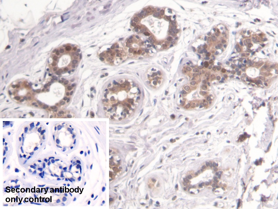 Monoclonal Antibody to Proliferating Cell Nuclear Antigen (PCNA)