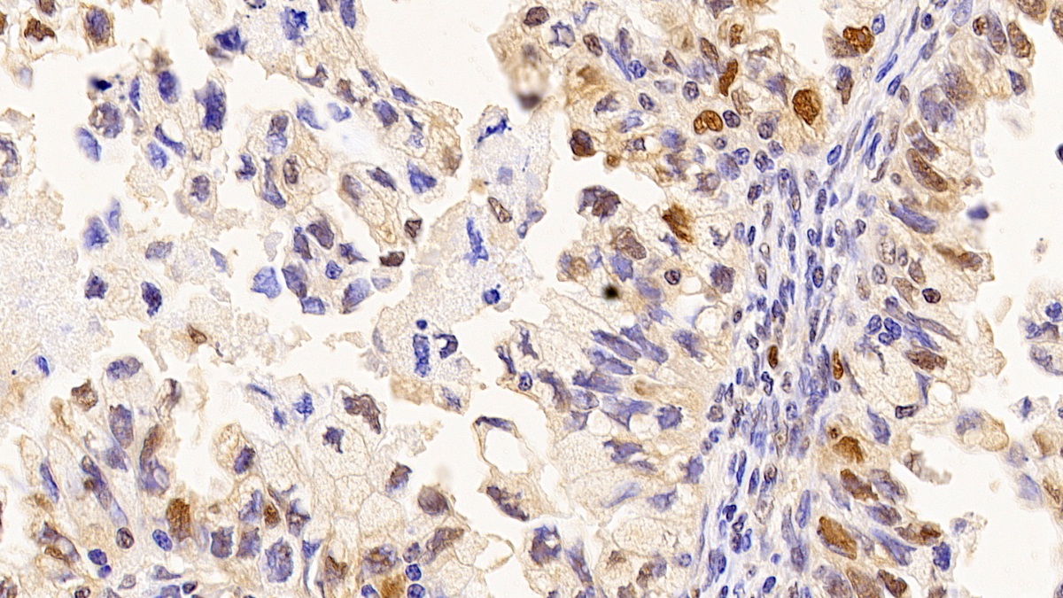 Monoclonal Antibody to Proliferating Cell Nuclear Antigen (PCNA)