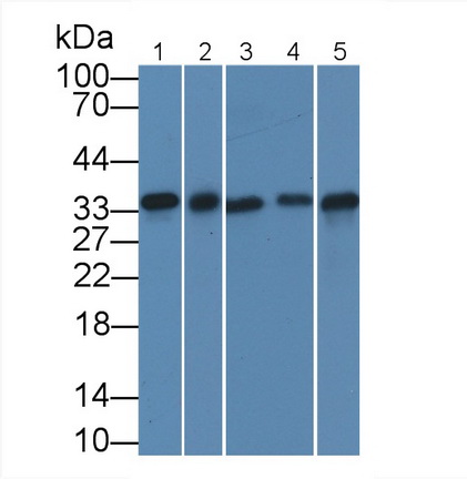 Monoclonal Antibody to Proliferating Cell Nuclear Antigen (PCNA)