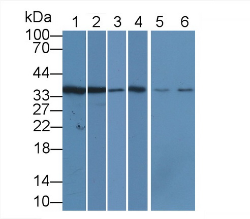 Monoclonal Antibody to Proliferating Cell Nuclear Antigen (PCNA)