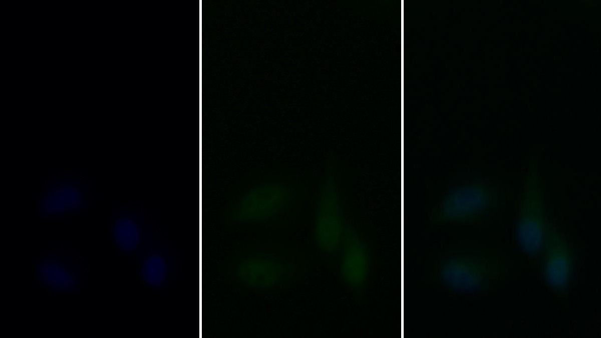 Monoclonal Antibody to Proliferating Cell Nuclear Antigen (PCNA)