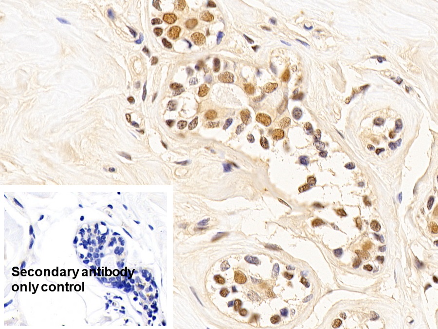 Monoclonal Antibody to Proliferating Cell Nuclear Antigen (PCNA)