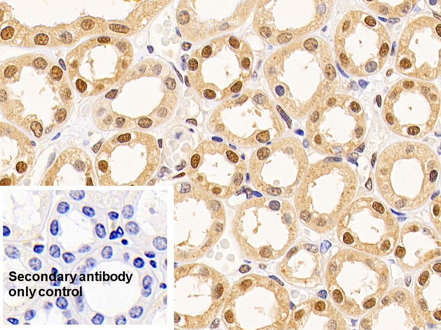 Monoclonal Antibody to Proliferating Cell Nuclear Antigen (PCNA)