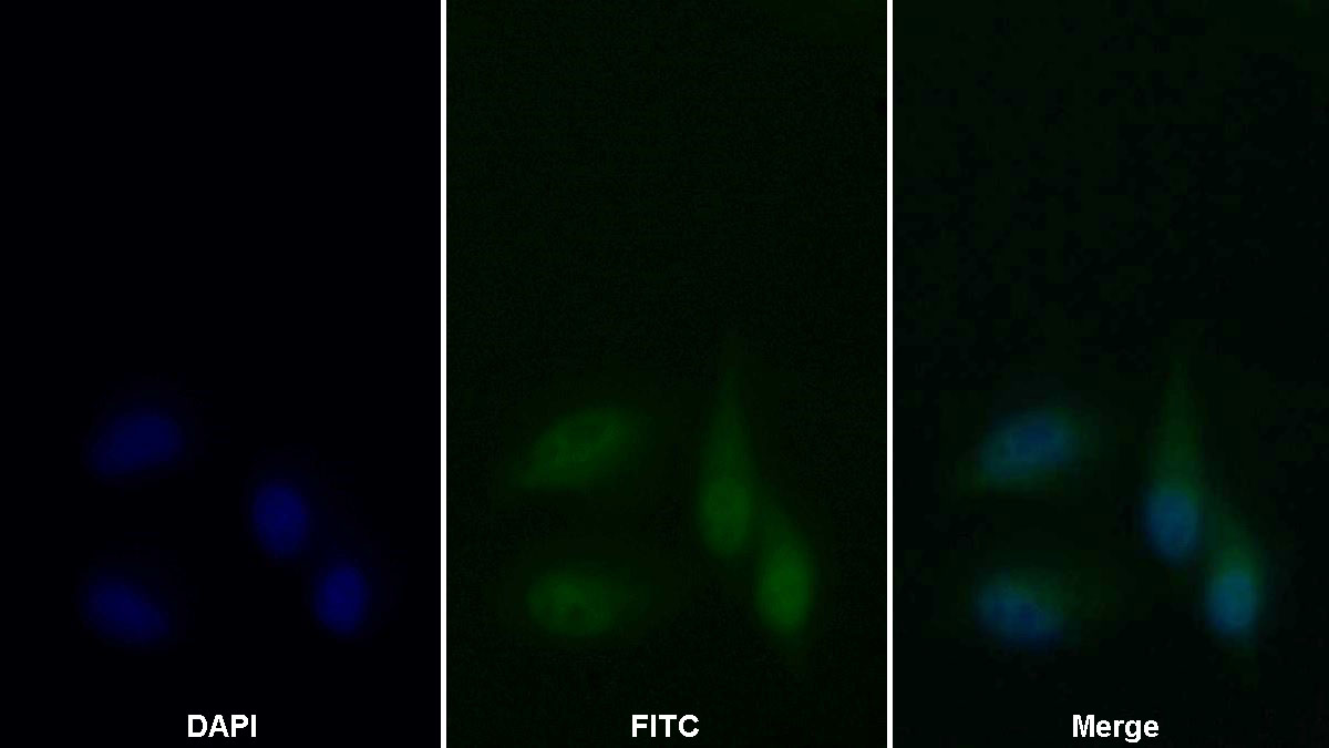 Monoclonal Antibody to Proliferating Cell Nuclear Antigen (PCNA)