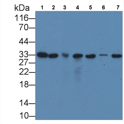 Monoclonal Antibody to Proliferating Cell Nuclear Antigen (PCNA)