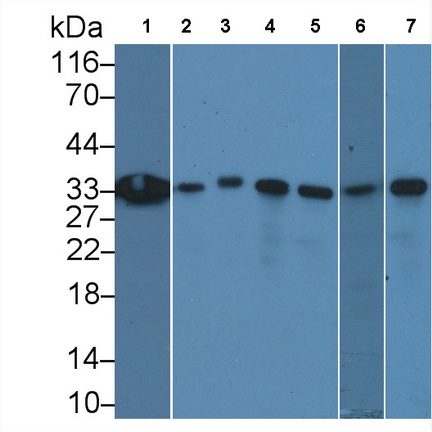 Monoclonal Antibody to Proliferating Cell Nuclear Antigen (PCNA)