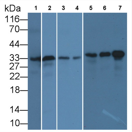 Monoclonal Antibody to Proliferating Cell Nuclear Antigen (PCNA)