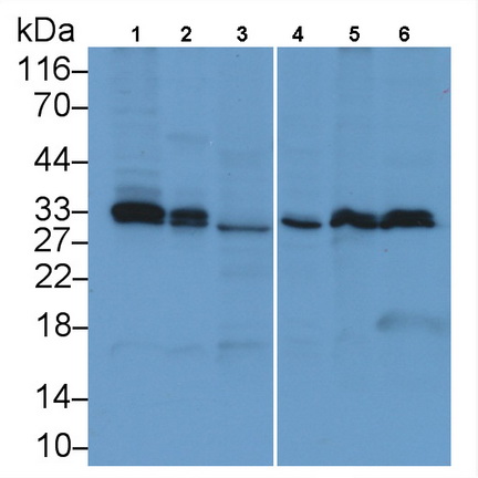 Monoclonal Antibody to Proliferating Cell Nuclear Antigen (PCNA)