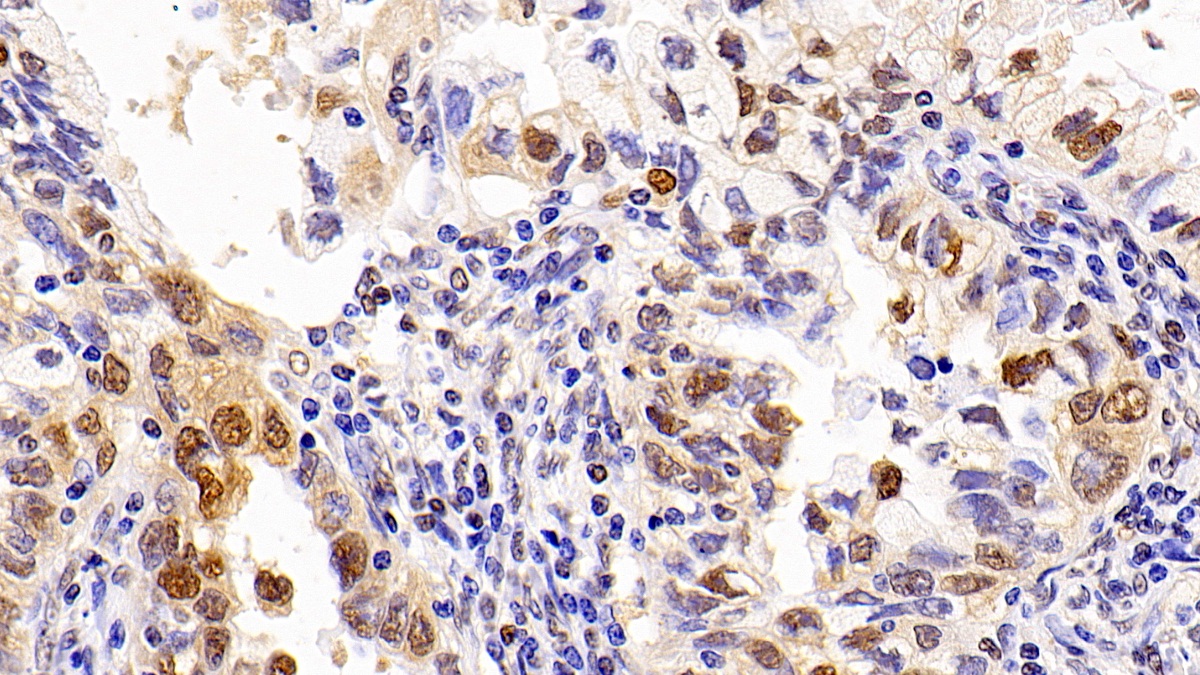 Monoclonal Antibody to Proliferating Cell Nuclear Antigen (PCNA)