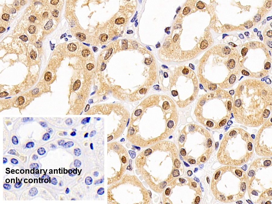 Monoclonal Antibody to Proliferating Cell Nuclear Antigen (PCNA)