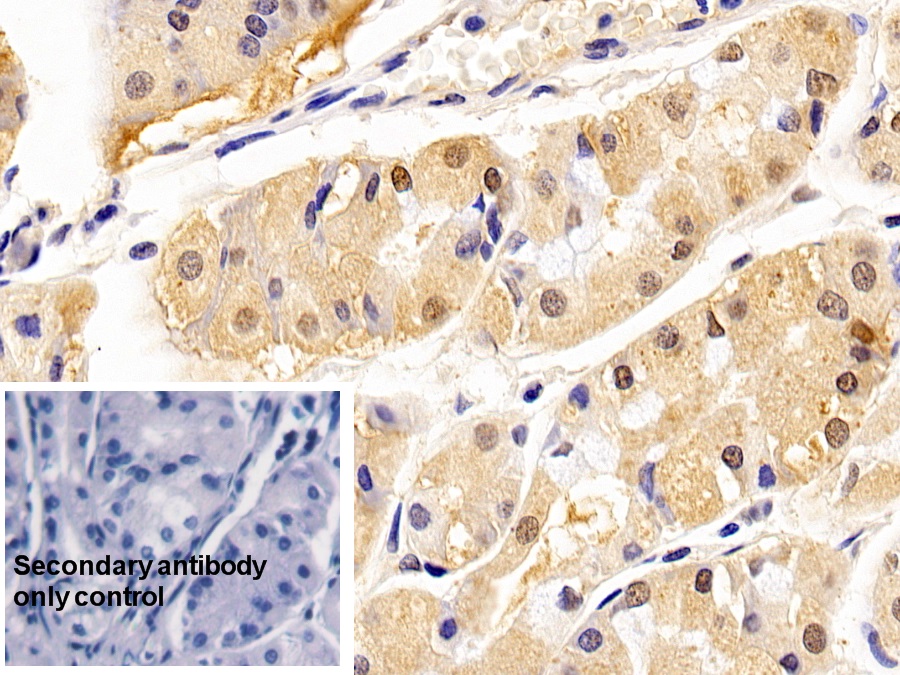 Monoclonal Antibody to Proliferating Cell Nuclear Antigen (PCNA)