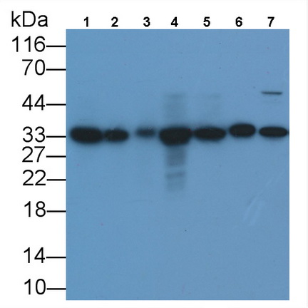 Monoclonal Antibody to Proliferating Cell Nuclear Antigen (PCNA)