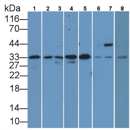 Monoclonal Antibody to Proliferating Cell Nuclear Antigen (PCNA)