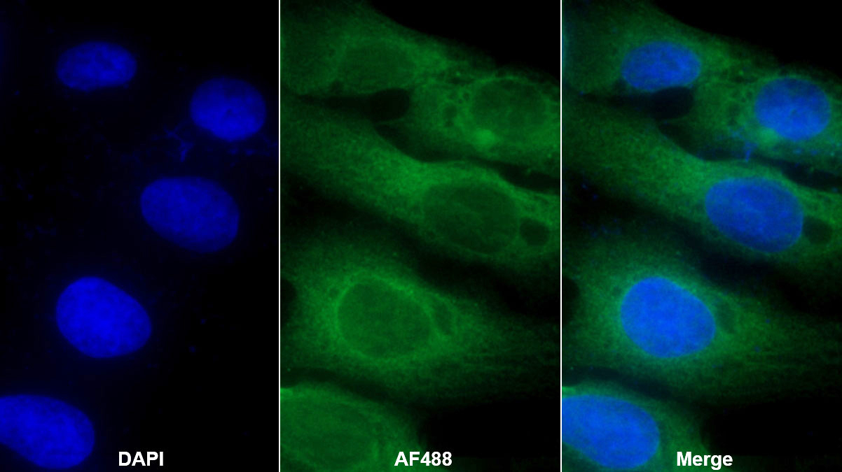 Monoclonal Antibody to Somatostatin (SST)