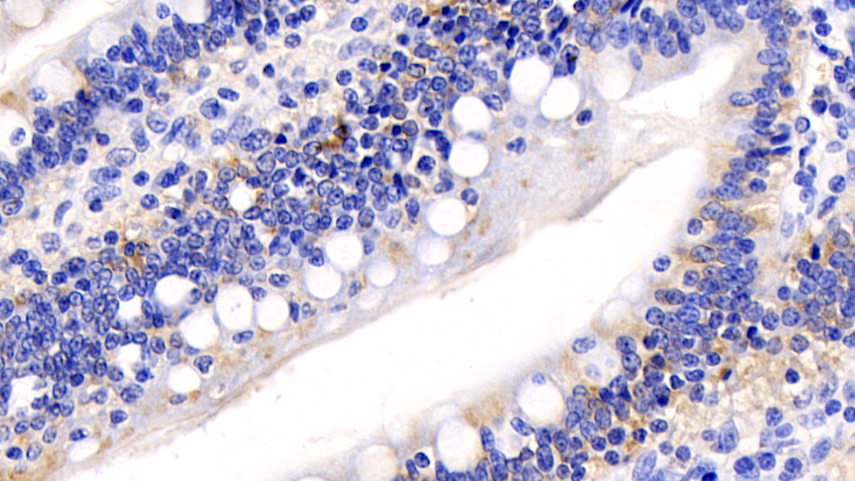 Monoclonal Antibody to Cytochrome C (CYCS)