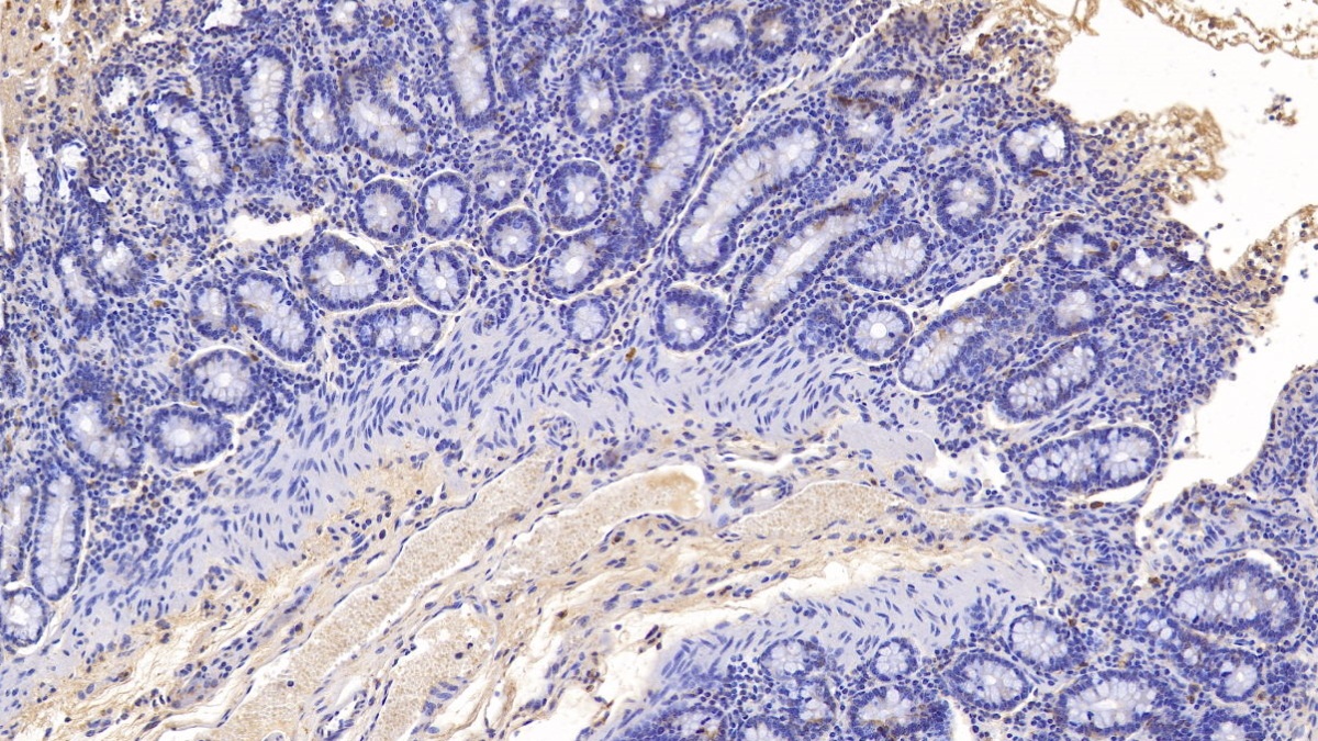 Monoclonal Antibody to Myeloperoxidase (MPO)