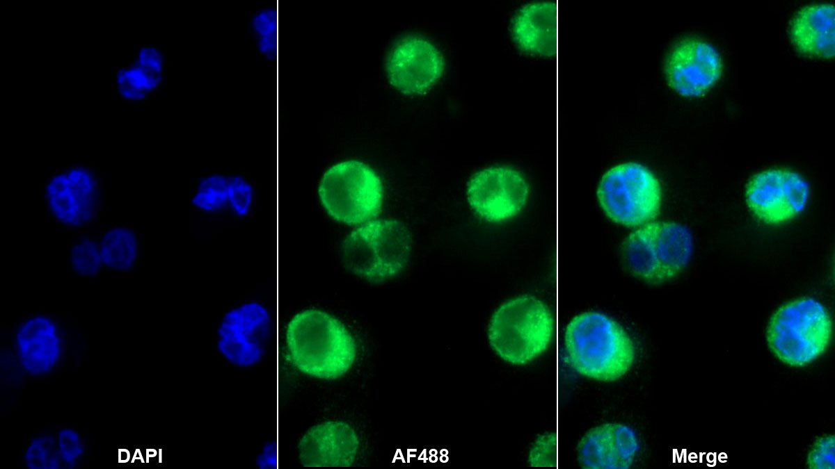 Monoclonal Antibody to Myeloperoxidase (MPO)