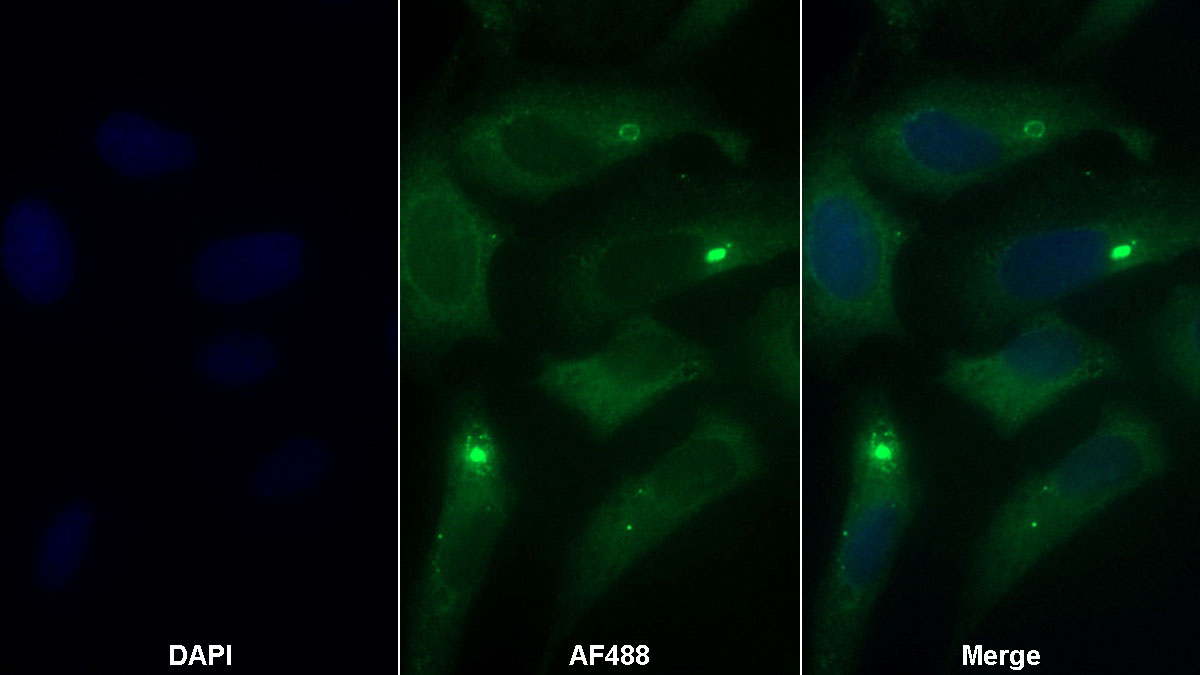 Monoclonal Antibody to Myeloperoxidase (MPO)