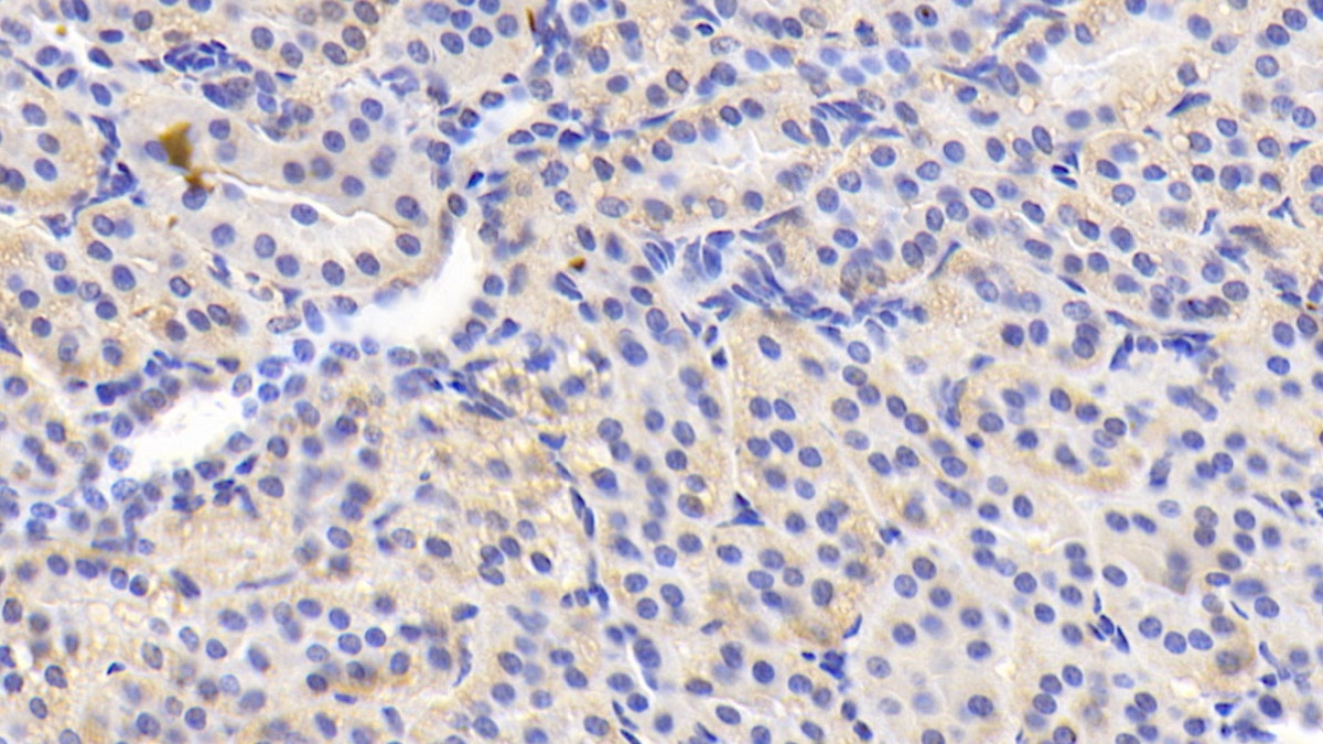 Monoclonal Antibody to Adiponectin (ADPN)