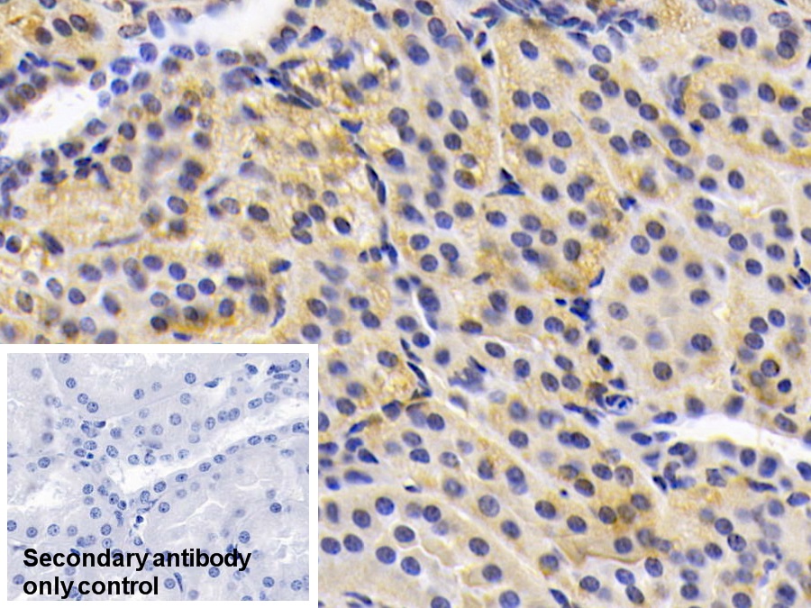 Monoclonal Antibody to Adiponectin (ADPN)