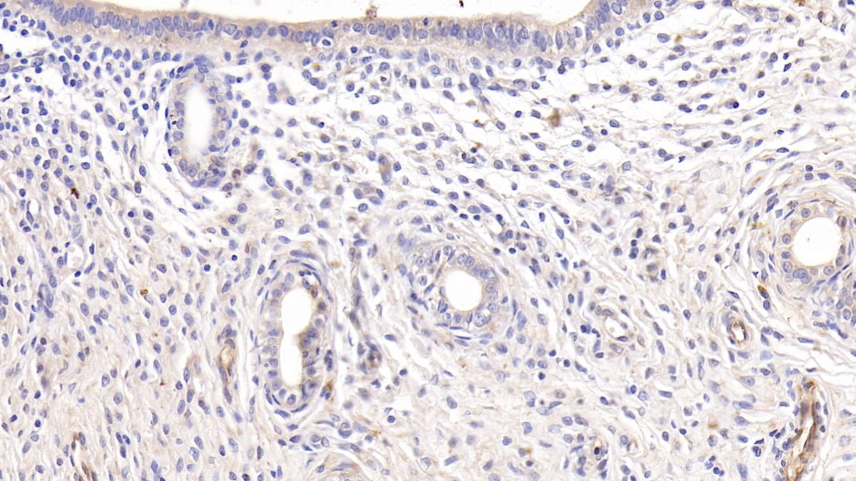 Monoclonal Antibody to Adiponectin (ADPN)