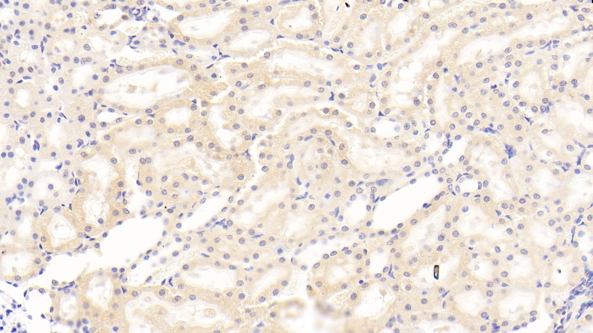 Monoclonal Antibody to Adiponectin (ADPN)