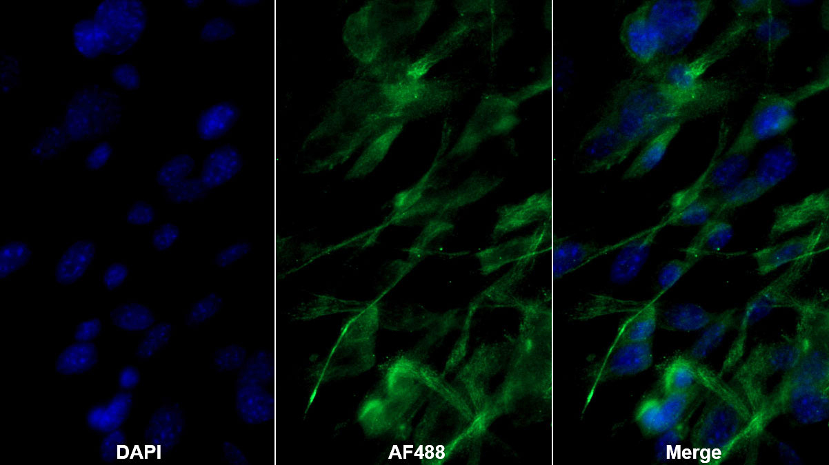 Monoclonal Antibody to Adiponectin (ADPN)