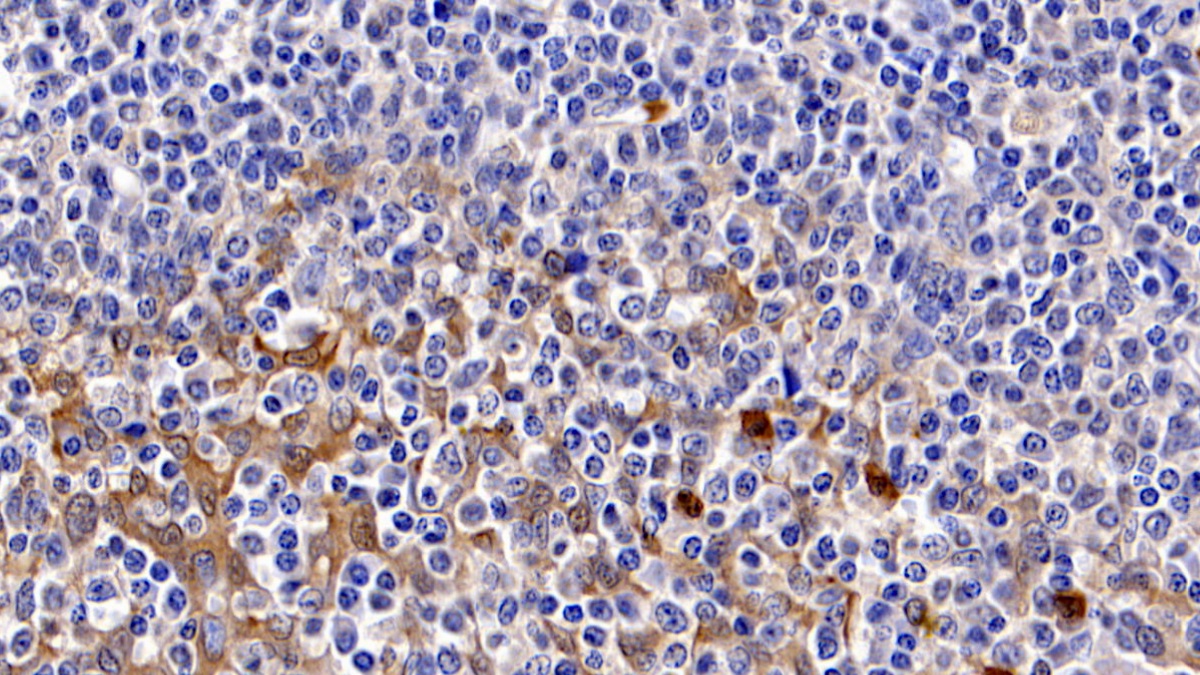 Monoclonal Antibody to Caspase 3 (CASP3)