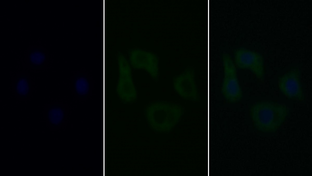 Monoclonal Antibody to Caspase 9 (CASP9)