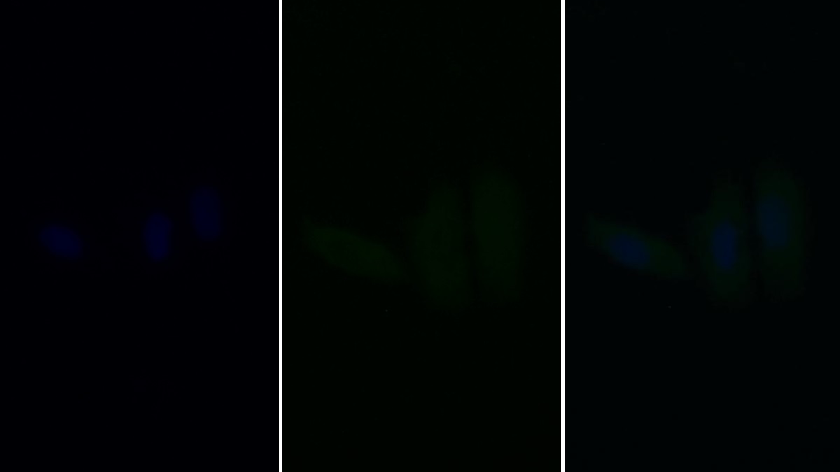 Monoclonal Antibody to Caspase 9 (CASP9)