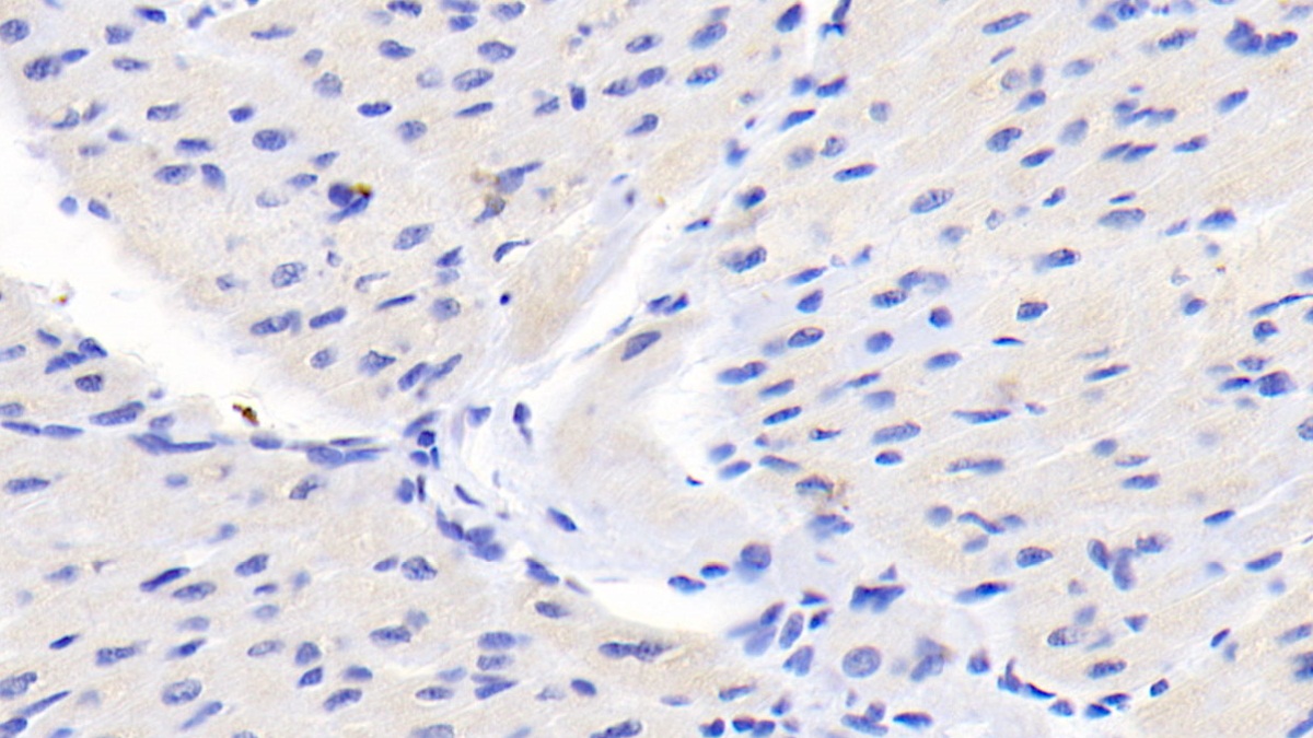 Monoclonal Antibody to Caspase 9 (CASP9)