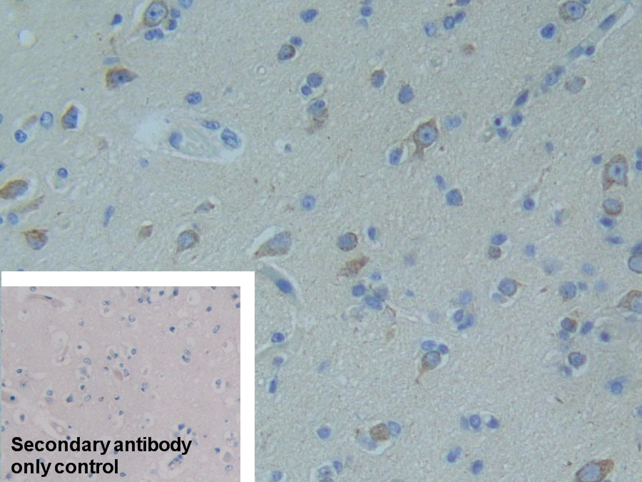 Monoclonal Antibody to Complement Factor H (CFH)