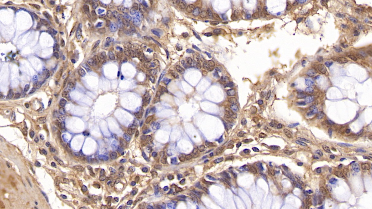 Monoclonal Antibody to Visfatin (VF)